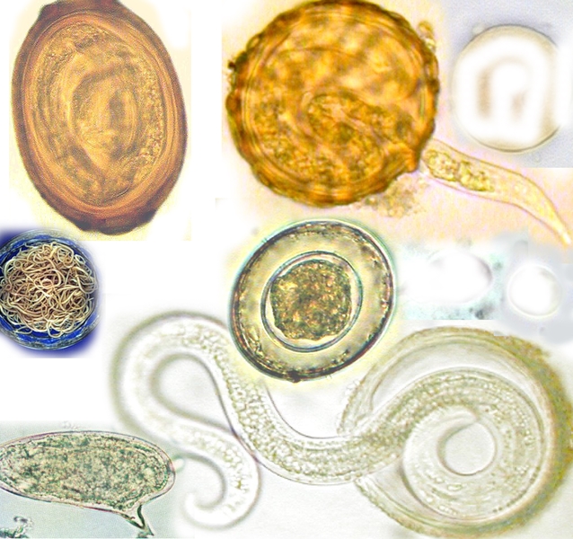 A collage of various microscopic images depicting different parasitic eggs and worms.