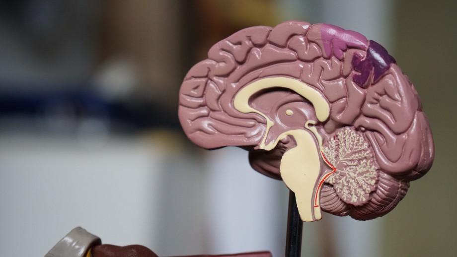 A close-up of a detailed, colorful plastic model of the human brain displayed on a stand.