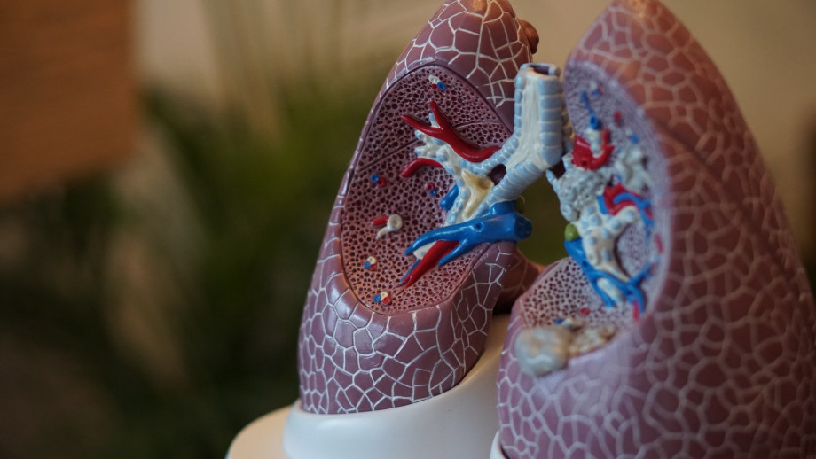 tuberculosis