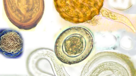 A collage of various microscopic images depicting different parasitic eggs and worms.