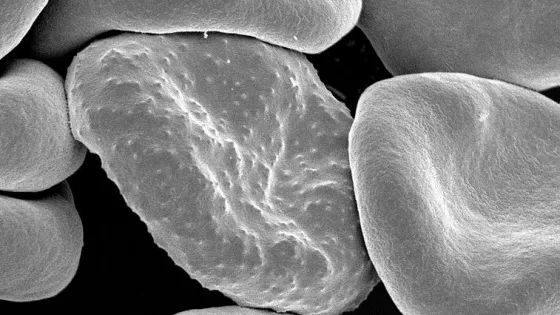 Close-up black and white image of blood cells under a scanning electron microscope.